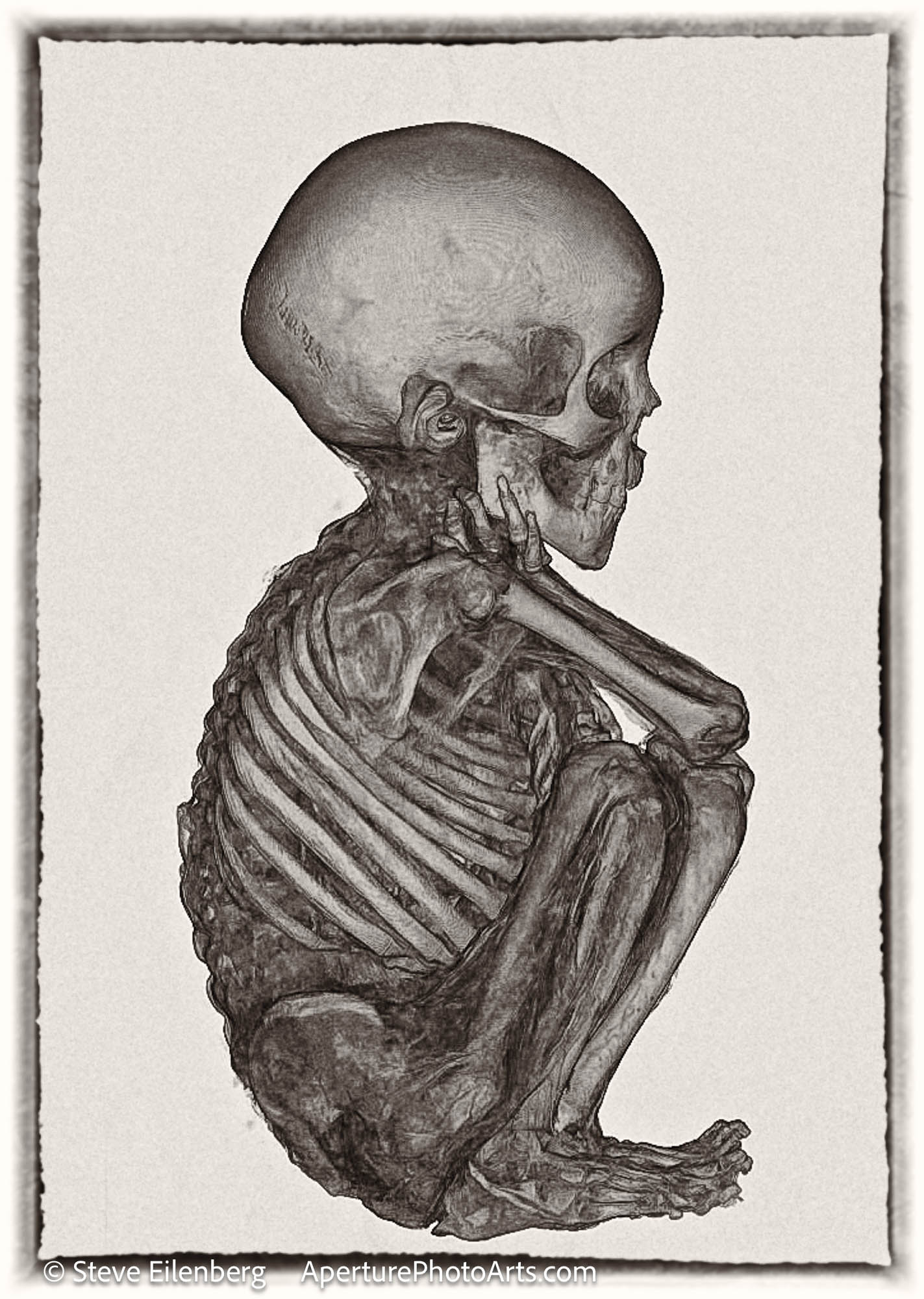 X-Ray Peruvian mummy